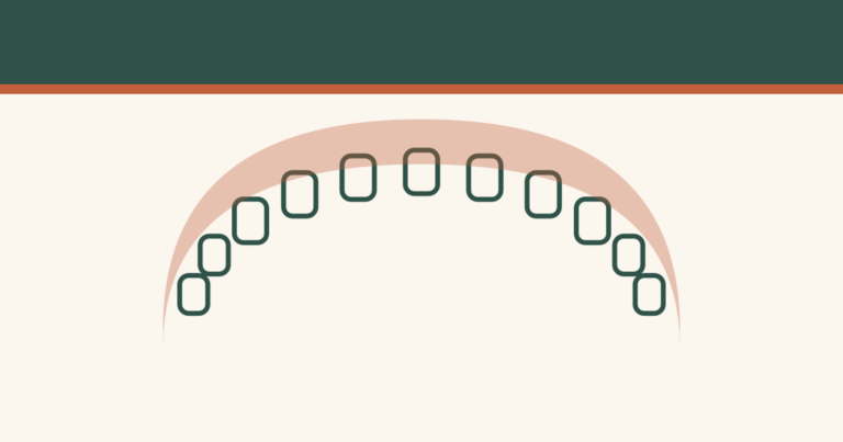 Orthodontie invisible